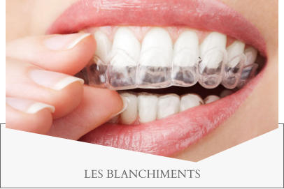 LES BLANCHIMENTS