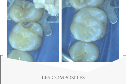 LES COMPOSITES
