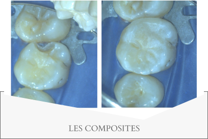 LES COMPOSITES